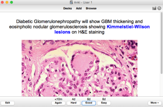 Screen Shot 2017-05-08 at 12.11.49 PM.png